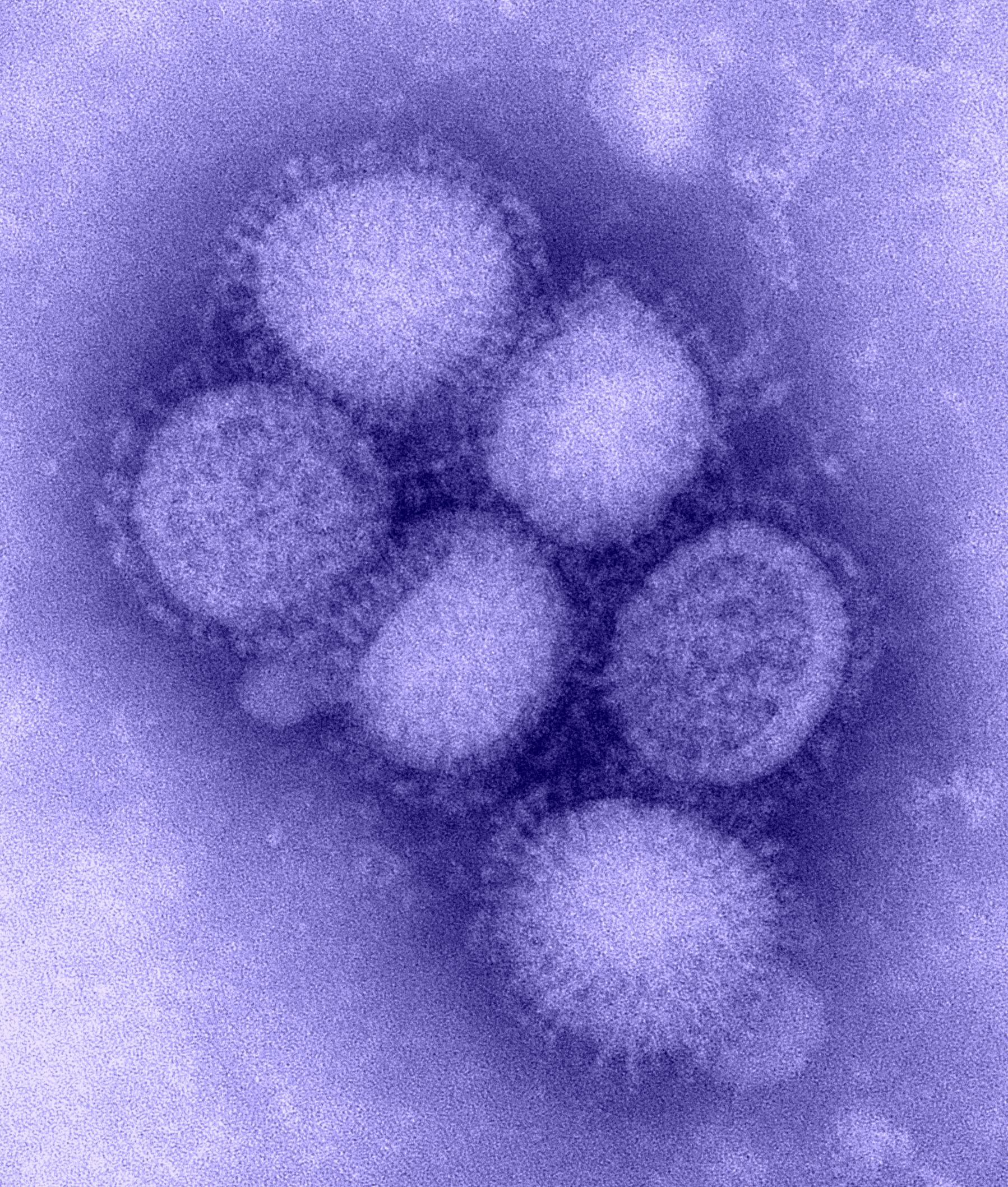 The H1N1 virus: Photo: CDC Influenza Laboratory