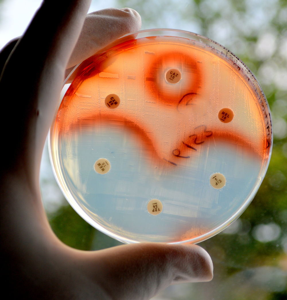 Antimicrobial resistance poses significant challenges to human health and drug development. Photo: iStock